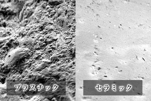 セラミックとプラスチックの虫歯や歯周病のリスクの比較